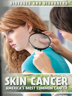 cover image of Skin Cancer
